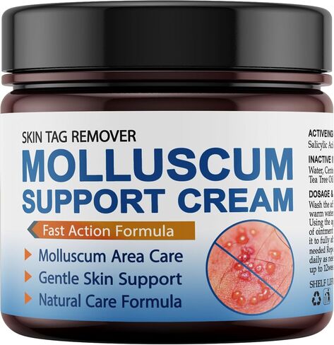 Molluscum Support Treatment, Molluscum Support Cream All Natural Support Cream for Molluscum Rash, 30g in Kuwait