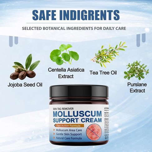 Molluscum Support Treatment, Molluscum Support Cream All Natural Support Cream for Molluscum Rash, 30g in Kuwait