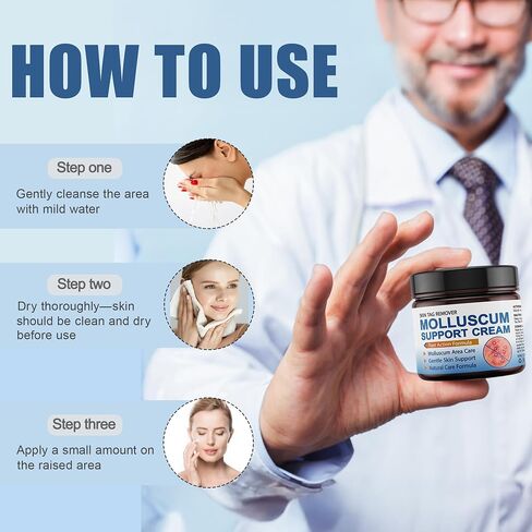 Molluscum Support Treatment, Molluscum Support Cream All Natural Support Cream for Molluscum Rash, 30g in Kuwait