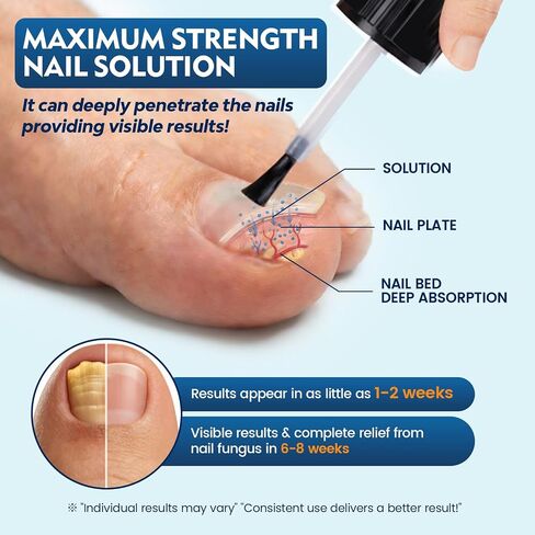 Toenail Fungus Treatment Extra Strength, Nail Fungus Treatment for Thick, Discolored Fungi Nails - 25% Undecylenic Acid All-in-One Kit with 30ML Fungi Nail Solution, 2 Nail Repair Pens in Saudi Arabia