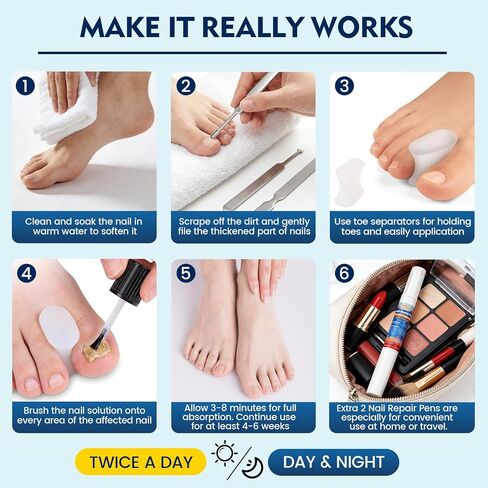 Toenail Fungus Treatment Extra Strength, Nail Fungus Treatment for Thick, Discolored Fungi Nails - 25% Undecylenic Acid All-in-One Kit with 30ML Fungi Nail Solution, 2 Nail Repair Pens in Saudi Arabia