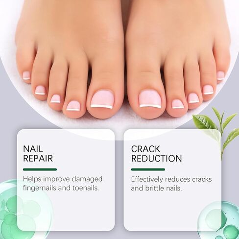 Toenail Fungus Pen, Nail Fungus Pen, Toenail Fungus Treatment Extra Strength, Toe Nail Fungus Treatments, Nail Repair for Damaged Nails in Saudi Arabia