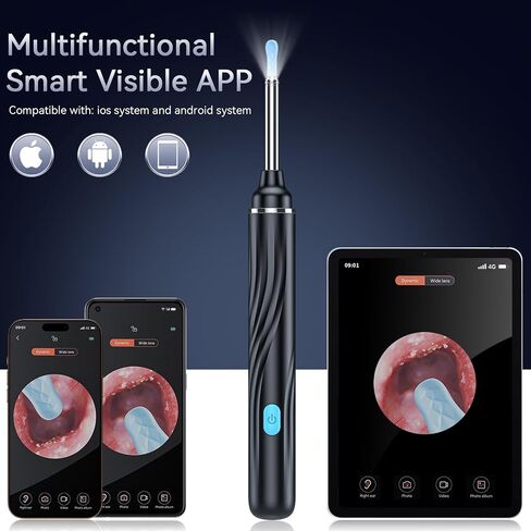 Tomaje Ear Wax Removal Tool Camera, Ear Cleaner with Camera, Ear Wax Removal Kit, 1080P HD Ear Camera, Earwax Removal Kit with Camera and 6 LED Light, 6 Ear Pick & Ear Set for iOS & Android, Black in Kuwait