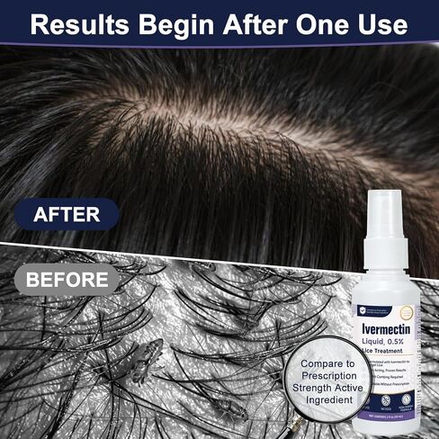 Ivermectin Liquid 0.5% Lice Treatment for Adults (2 Fl Oz), Fast-Acting, Prescription Strength Head Lice & Egg Treatment, Topical Liquid Formula, for Adults in Saudi Arabia