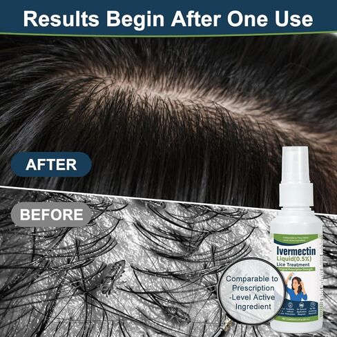 lvermect Liquid for Adults (2 Fl Oz), Lightweight Hair, Fast-Apply Topical Liquid Formula, for Head Lice & Egg Care in Saudi Arabia