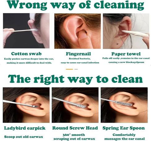 مجموعة أدوات تنظيف شمع الأذن الزنبركية لإزالة شمع الأذن من Soottaci، منظف احترافي للأذن، أداة تنظيف تدليك الأذن الحلزونية 360 درجة من الفولاذ المقاوم للصدأ مع صندوق تخزين وفرشاة تنظيف (13 قطعة) in Kuwait