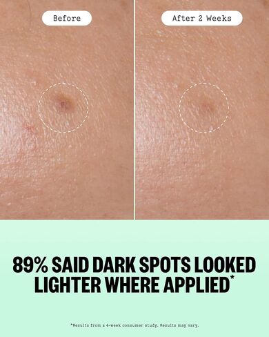 PEACE OUT Microneedling Dots for Dark Spots, Targeted Spot Patches with Dissolving Microneedles, Niacinamide, Hydrocolloid, Skincare for Uneven Tone and Texture (12 Count) in Saudi Arabia