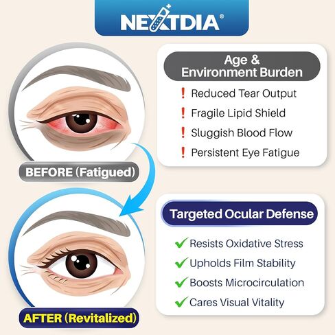 Lutein and Zeaxanthin Supplement, Eye Health Gummies, AREDS2-Based Formula, Omega-3, Zinc, Brain Focus & Learning, Vision Support, Blue Light Filtering, Adults & Seniors, Sugar Free, Vegan, 120 Count in Kuwait