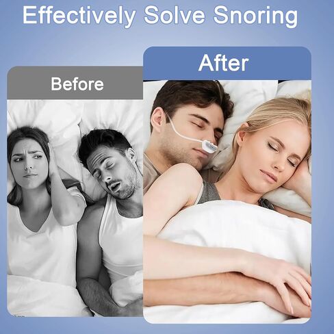 Anti Snoring Devices,Automatic Nasal Dilator & Rechargeable Air Purifier Filter,Effective to Relieve Snoring,Adjustable Wind Speed,Suitable for All Nose Shapes,Compact & Lightweight for Travel in Saudi Arabia