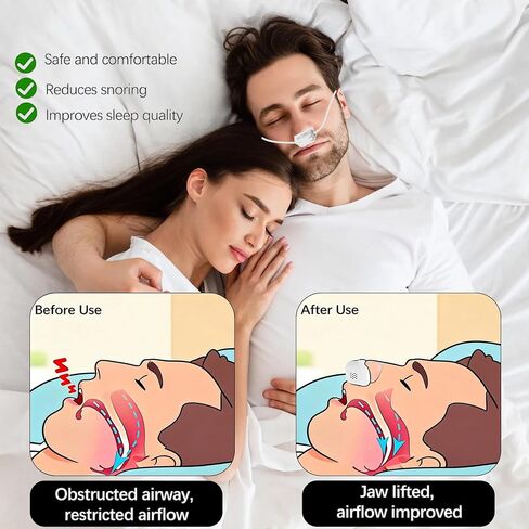 Anti Snoring Devices,Automatic Nasal Dilator & Rechargeable Air Purifier Filter,Effective to Relieve Snoring,Adjustable Wind Speed,Suitable for All Nose Shapes,Compact & Lightweight for Travel in Saudi Arabia