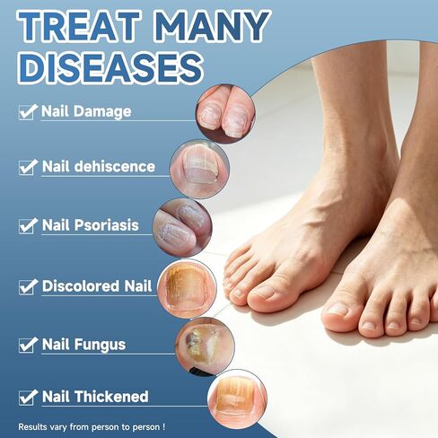 Toenail Fungus Treatment Extra Strength - Fast Acting Liquid Drops for Finger & Toe Nails, Restore and Repair Damaged, Discolored Nails - 2Pcs in Saudi Arabia
