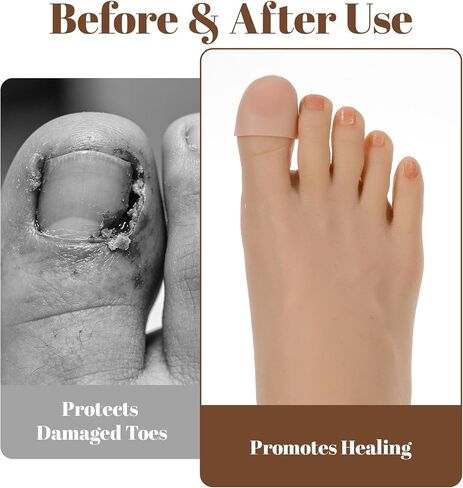 16 Pcs Big Toe Protectors, Soft Silicone Toe Bandages for Big Toes, Waterproof Toes Caps Guards Ideal for Ingrown Toenails, Blisters & Corns (Skin Tone, Small: 0.98 x 0.59 x 0.59 in) in Saudi Arabia