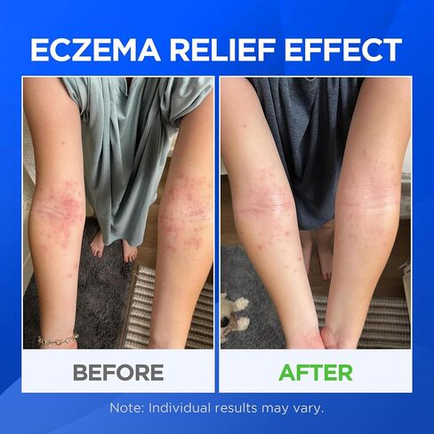 AOSORW Eczema Relief Oatmeal Cream - Colloidal Oatmeal 1% Skin Protectant - Helps Relieve Dry, Itchy Skin Due to Eczema & Rashes - Fragrance-Free, Steroid-Free - 3.5 Oz in Kuwait
