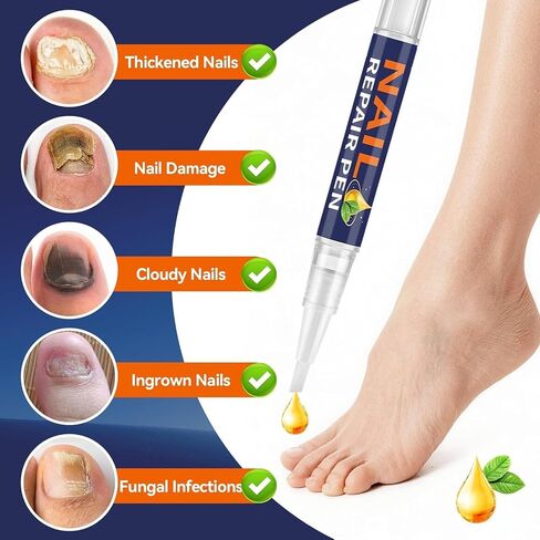 Toenail Fungus Treatment Extra Strength，Nail Repair Pen for Damaged Nails，Nail Fungus Pen, 25% Undecylenic Acid with added Tea Tree Oil Fast-Acting Solution for Brittle & Discoloration Nails in Saudi Arabia