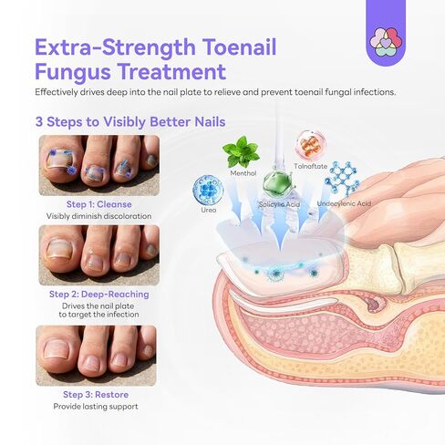 SAVILAND Toenail Fungus Treatment Extra Strength: FSA-HSA 2X Extreme Nail Repair for Discolored and Damaged Nails Toenail Softener Yellow Toenail Foot Toe Thick Nail Fungus Treatments Solution,2 fl oz in Saudi Arabia