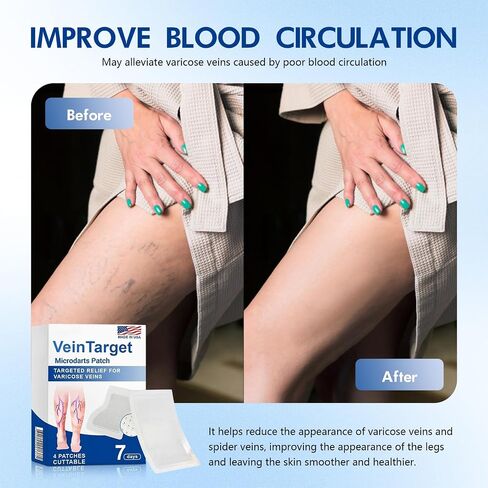 VeinTarget Microdarts Patch - Improves the Appearanceof Leg, 2026 New Leg Renew Varicose Veins Patch,VeinTarget Patches for Legs Care - All Skin Types (2 Boxes) in Saudi Arabia