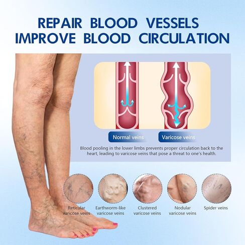 VeinTarget Microdarts Patch - Improves the Appearanceof Leg, 2026 New Leg Renew Varicose Veins Patch,VeinTarget Patches for Legs Care - All Skin Types (2 Boxes) in Saudi Arabia