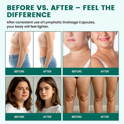 Lymphatic Drainage Capsules – Advanced Lymphatic System Support, Lymphatic Complex – with Echinacea, Dandelion, Bromelain, Horse Chestnut, for Fluid Balance, Immune & Liver Health – 60 Capsules in Kuwait