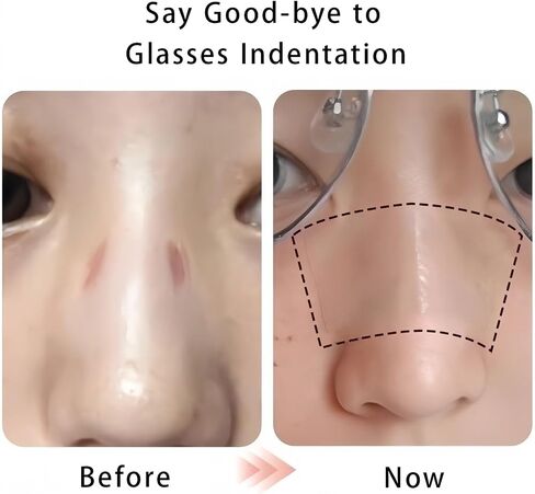 Eyeglass Nose Pad Cushions -Skin Color- Relieve Red Marks Indentation | Pressure Red Marks & Indentation for Glasses Nose Bridge Protector in Saudi Arabia