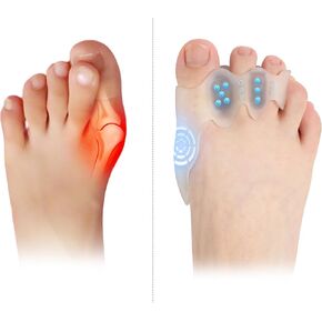 Toe Spacers & Bunion Corrector for KidsMenWomen|Corn Callus Removers|Bunion Relief|Overlapping Toes Separators (Toe Corrector Set (2 Pair, 40 ct Fillers), Large-Teens/Adults) in Saudi Arabia