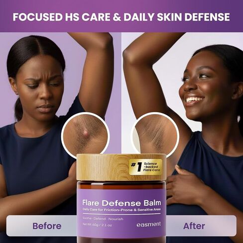 Hidradenitis Suppurativa Flare Defense Balm Cooling Formula: Daily Protection for Flare-Prone, Bump-Prone, Friction-Prone Skin – Non-Greasy, Non-Staining (2 Ounce (Pack of 2)) in Saudi Arabia