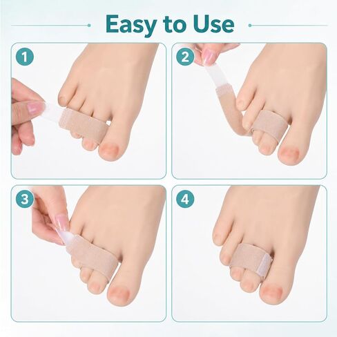 12 Pack Fabric Hammer Toe Correctors, Broken Toe Wrap, Reusable Buddy Tape Splints Straightener, Crooked Bent Toes, Bunions Support & Protection (Skin Color) in Kuwait