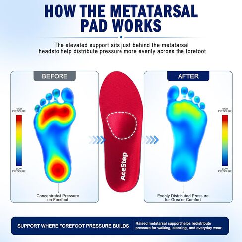 Metatarsalgia Insoles-Shoe Inserts for Morton’s Neuroma, Ball of Foot Pain | Orthotic Arch Support Insoles for Flat Feet, Over Pronation, Plantar Fasciitis Insoles for Men & Women in Kuwait