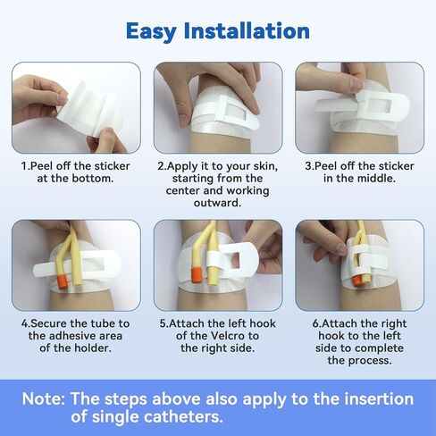 Catheter Stabilization Device, Catheter Securement Device with Extra-Large Self-Adhesive Hook, Breathable Catheter Stabilization Device for NG/J/G Feeding Tubes (60Pcs) in Kuwait