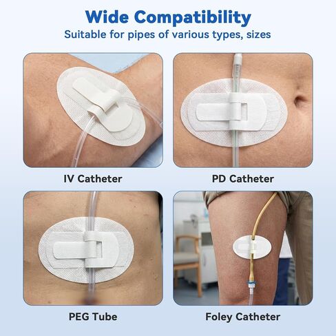 Catheter Stabilization Device, Catheter Securement Device with Extra-Large Self-Adhesive Hook, Breathable Catheter Stabilization Device for NG/J/G Feeding Tubes (60Pcs) in Kuwait