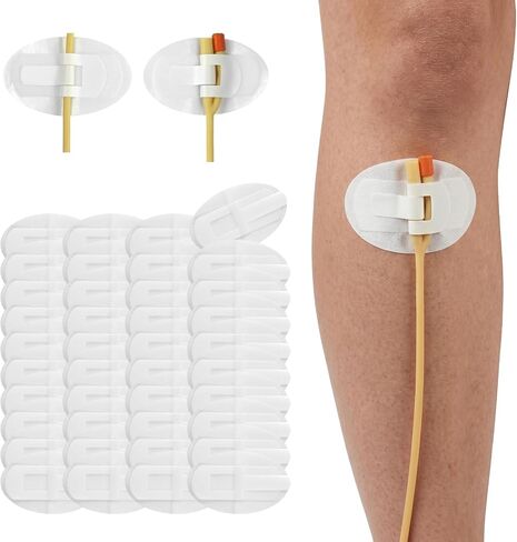 Catheter Stabilization Device, Catheter Securement Device with Extra-Large Self-Adhesive Hook, Breathable Catheter Stabilization Device for NG/J/G Feeding Tubes (60Pcs) in Kuwait