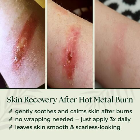 Natural Wound Care & Burn Gel – First Aid Gel for Cuts, Scrapes & Burns – Advanced Skin Repair Ointment & Cream Alternative– Stable at Room Temperature – Soothing Film-Forming Barrier – Fragrance-Free in Kuwait