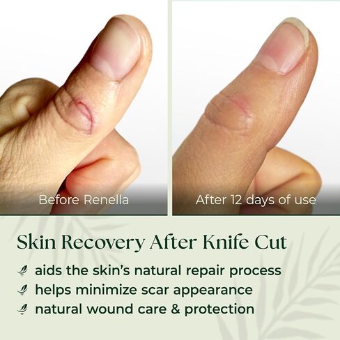 Natural Wound Care & Burn Gel – First Aid Gel for Cuts, Scrapes & Burns – Advanced Skin Repair Ointment & Cream Alternative– Stable at Room Temperature – Soothing Film-Forming Barrier – Fragrance-Free in Kuwait