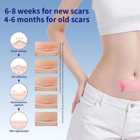 Silicone Scar Sheets 1.6"x39.4" Roll-1M Scars Removal Treatment Medical Grade Silicone Scar Tape for Skin Resuable Strip for Tummy Tuck,Incision,Keloid,C-Section,Burn,Acne Scars(pink) in Saudi Arabia