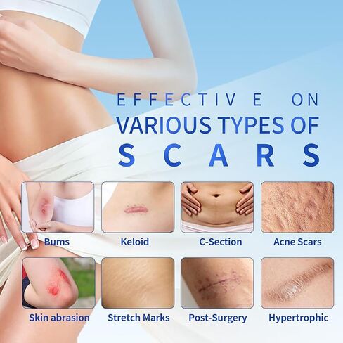Silicone Scar Sheets 1.6"x39.4" Roll-1M Scars Removal Treatment Medical Grade Silicone Scar Tape for Skin Resuable Strip for Tummy Tuck,Incision,Keloid,C-Section,Burn,Acne Scars(pink) in Saudi Arabia