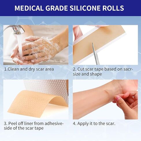 Silicone Scar Sheets 1.6"x39.4" Roll-1M Scars Removal Treatment Medical Grade Silicone Scar Tape for Skin Resuable Strip for Tummy Tuck,Incision,Keloid,C-Section,Burn,Acne Scars(pink) in Saudi Arabia
