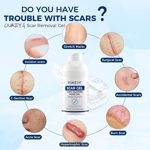OUKEYA Silicone Scar Gel - 100% Silicone Cream Perfect for Sensitive Skin, Say Goodbye to Old and New Scars (30ml) in Kuwait