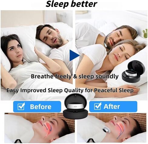 Z3 Pro Snoring Solution,Z3 Pro - Professional Anti-Snoring Device 3 Adjustable Levels Portable Sleep Device Improved Sleep Quality for Peaceful Sleep (1 PC with 10 Patches) in Saudi Arabia