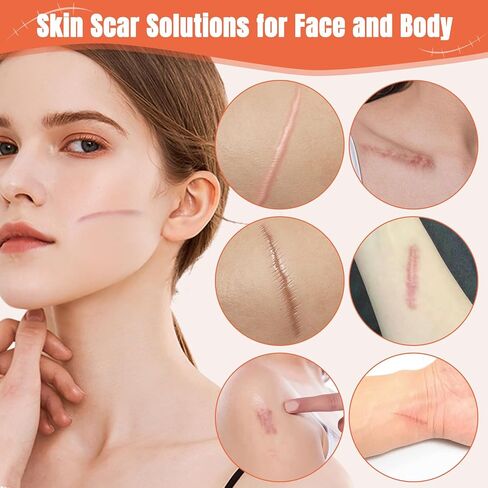 2Pcs Silicone Scar Stick, 60% Scar Solutions for Face and Body Skin, Gentle Ingredients on All Skin Types, Lightweight & Easy to Apply in Saudi Arabia