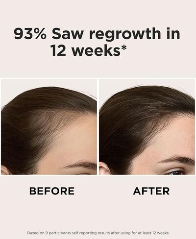 Solaris Laboratories NY Intensive LED Headband: Support Growth and Strength + 90 day Hair Journal in Kuwait