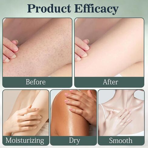 2Pcs Intertrigo Cream,Non Greasy Moisture Control Formula for Daily Comfort,Skin Fold Care & Chafing Support Cream,Helps Soothe Skin & Reduce Friction,for Underarms,Inner Thighs & Other Areas in Saudi Arabia