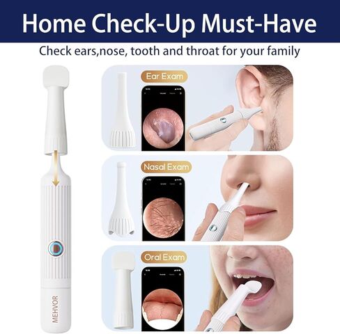 Ear Wax Removal Tool Camera, Smart WiFi Ear Cleaner with Camera, HD Visual Otoscope, Safe Silicone Flexible Scoops & Tweezers Sets Tools for Adults & Kids in Saudi Arabia