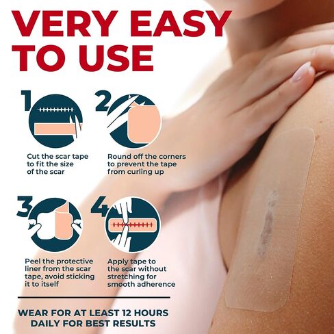 Medical Grade Silicone Scar Tape - 1.6"x70" - Effective Removal of Surgical, Keloid, C-Section, Tummy Tuck, Hypertrophic and Acne Scars - Easy to Use Treatment - Reusable Silicone Scar Sheets in Saudi Arabia
