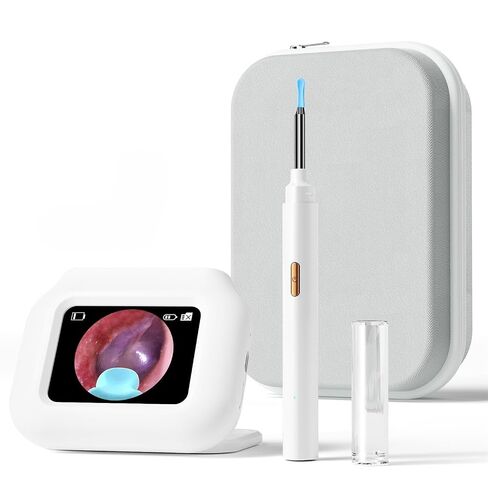 Ear Wax Removal Tool Camera with Screen, Smart Screen Ear Wax Removal Kit with 2.8'' HD Display, WiFi Automatic Connect - Ear Cleaner Tool with Camera&Screen, 6 Replaceable Tips, No App/Phone Needed in Saudi Arabia