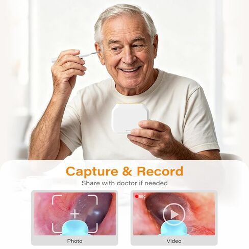 Ear Wax Removal Tool Camera with Screen, Smart Screen Ear Wax Removal Kit with 2.8'' HD Display, WiFi Automatic Connect - Ear Cleaner Tool with Camera&Screen, 6 Replaceable Tips, No App/Phone Needed in Saudi Arabia