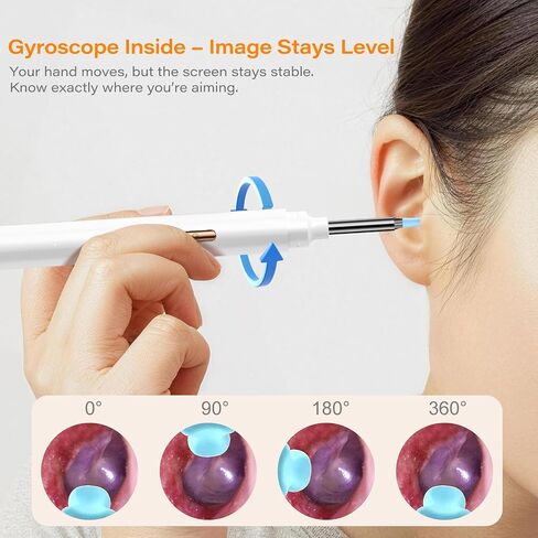 Ear Wax Removal Tool Camera with Screen, Smart Screen Ear Wax Removal Kit with 2.8'' HD Display, WiFi Automatic Connect - Ear Cleaner Tool with Camera&Screen, 6 Replaceable Tips, No App/Phone Needed in Saudi Arabia