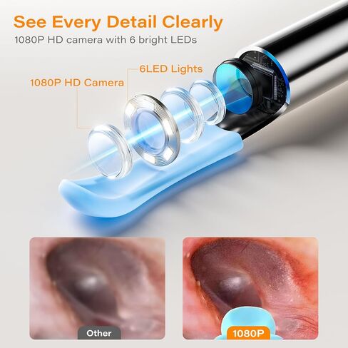 Ear Wax Removal Tool Camera with Screen, Smart Screen Ear Wax Removal Kit with 2.8'' HD Display, WiFi Automatic Connect - Ear Cleaner Tool with Camera&Screen, 6 Replaceable Tips, No App/Phone Needed in Saudi Arabia