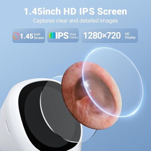 ScopeAround Otoscope with Light, 1.45" IPS Display Digital Otoscope, 3.9mm Ear Camera with Ear Wax Removal Tools, Ear Scope with Extention Cable, 6 LED Lights, Capture Photos Videos, White in Kuwait