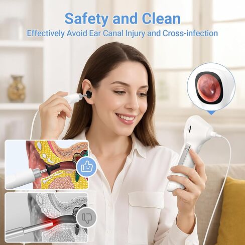 ScopeAround Otoscope with Light, 1.45" IPS Display Digital Otoscope, 3.9mm Ear Camera with Ear Wax Removal Tools, Ear Scope with Extention Cable, 6 LED Lights, Capture Photos Videos, White in Kuwait