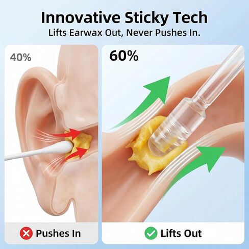 Upgraded Sticky Ear Cleaning Stick, 24 Pcs Reusable Earwax Removal Tool Kit, Soft Resin Adhesive Tips Ear Cleaner for Adults & Kids,Portable Set in Kuwait
