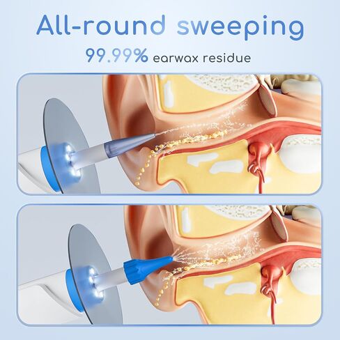 Earwax Removal - Electric Ear Irrigation Kit with 4 Pressure Modes, Ear Cleaner with Camera, 1080P Otoscope, Ear Cleaning Tool with 7-Piece Set, Earwax Removal Kit for Daily Cleaning(White) in Saudi Arabia